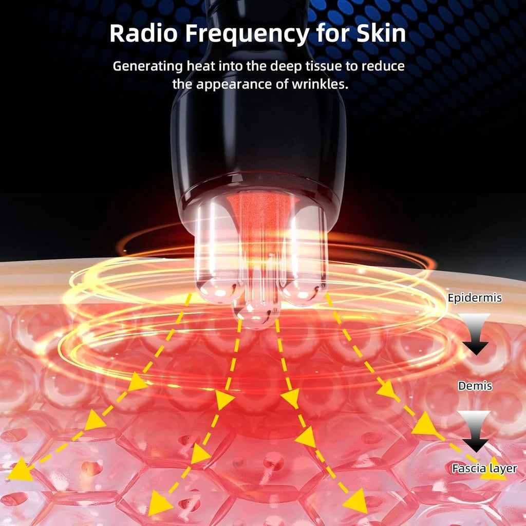 MZONG Radio Frequency Skin Care Device for Skin Wrinkles with Light Based